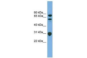SH3KBP1 antibody used at 1 ug/ml to detect target protein. (SH3KBP1 anticorps  (N-Term))