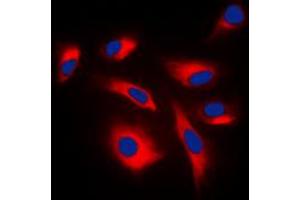 Immunofluorescent analysis of MKK1/2 (pS222/226) staining in K562 cells. (MEK1 anticorps  (pSer222, pSer226))