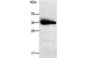 Western Blot analysis of Human liver cancer tissue using PLPP1 Polyclonal Antibody at dilution of 1:650 (PLPP1 anticorps)