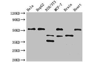 Western Blot Positive WB detected in: Hela whole cell lysate, HepG2 whole cell lysate, NIH/3T3 whole cell lysate, MCF-7 whole cell lysate, Mouse brain tissue, Rat heart tissue All lanes: LAX1 antibody at 2. (LAX1 anticorps  (AA 107-298))