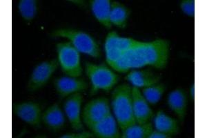 Detection of CDH16 in Human Hela Cell using Polyclonal Antibody to Cadherin 16 (CDH16)
