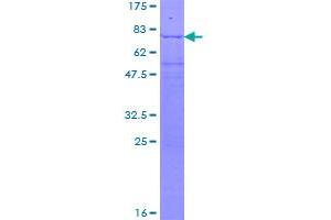 Image no. 1 for Eukaryotic Translation Initiation Factor 3 Subunit E (EIF3E) (AA 1-445) protein (GST tag) (ABIN1352556)