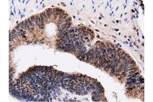 Immunohistochemical staining of paraffin-embedded Human Kidney tissue using anti-QPRT mouse monoclonal antibody. (QPRT anticorps)