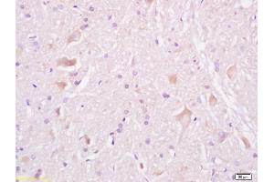 Formalin-fixed and paraffin embedded rat brain tissue labeled withAnti-Tuberin/TSC2 Polyclonal Antibody, Unconjugated (ABIN701200) at 1:200, followed by conjugation to the secondary antibody and DAB staining (Tuberin anticorps  (AA 1601-1750))