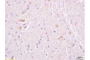 Formalin-fixed and paraffin embedded rat brain tissue labeled withAnti-Tuberin/TSC2 Polyclonal Antibody, Unconjugated (ABIN701200) at 1:200, followed by conjugation to the secondary antibody and DAB staining (Tuberin anticorps  (AA 1601-1750))