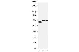 Western blot testing of SLC1A4 antibody and Lane 1:  human U87;  2: rat brain;  3: mouse brain tissue lysate. (SLC1A4 anticorps  (C-Term))