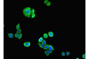 Immunofluorescent analysis of PC-3 cells cells using ABIN7146207 at dilution of 1:100 and Alexa Fluor 488-congugated AffiniPure Goat Anti-Rabbit IgG(H+L) (Cadherin 12 anticorps  (AA 56-605))