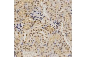 Immunohistochemistry of paraffin-embedded mouse kidney using BMI1 antibody at dilution of 1:200 (x400 lens).