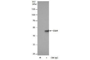 IP Image Immunoprecipitation of SSA1 protein from 293T whole cell extracts using 5 μg of SSA1 antibody [C1C3], Western blot analysis was performed using SSA1 antibody [C1C3], EasyBlot anti-Rabbit IgG  was used as a secondary reagent. (TRIM21 anticorps)