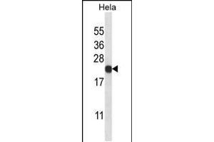 Western blot analysis in Hela cell line lysates (35ug/lane). (PSMB5 anticorps  (C-Term))