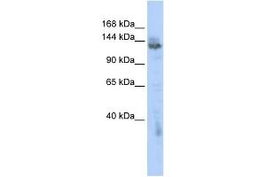 WB Suggested Anti-ZMYND8 Antibody Titration:  0. (ZMYND8 anticorps  (Middle Region))