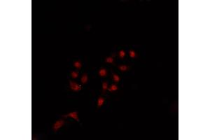 ABIN6269348 staining Jurkat cells by IF/ICC.