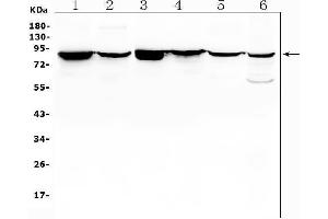 Western blot analysis of RDX using anti-RDX antibody (ABIN7602767).