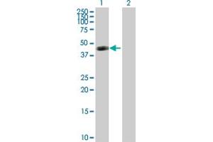 Western Blot analysis of ART3 expression in transfected 293T cell line by ART3 MaxPab polyclonal antibody. (ART3 anticorps  (AA 1-378))