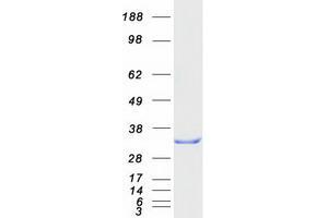 Validation with Western Blot