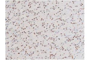 ABIN6267524 at 1/200 staining Rat ganstric tissue sections by IHC-P.