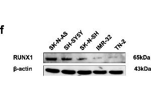 Identification of RUNX1 as an apoptosis transcription factor and an independent prognostic factor in NB tissue and cell lines. (RUNX1 anticorps  (AA 221-480))