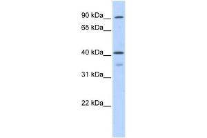 WB Suggested Anti-OAS1 Antibody Titration:  0. (OAS1 anticorps  (Middle Region))