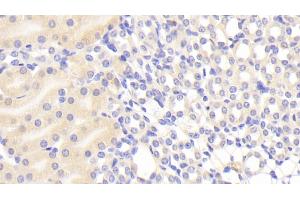 Detection of a1BG in Mouse Kidney Tissue using Polyclonal Antibody to Alpha-1-B-Glycoprotein (a1BG)