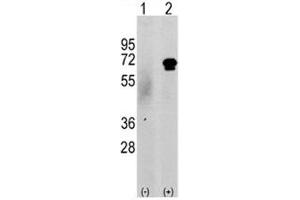 Western blot analysis of CAMKK2 antibody and 293 cell lysate either nontransfected (c) or transiently transfected with the CAMKK2 gene (2).