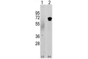 Western blot analysis of CAMKK2 antibody and 293 cell lysate either nontransfected (c) or transiently transfected with the CAMKK2 gene (2). (CAMKK2 anticorps  (AA 52-82))