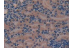 Detection of SOSTDC1 in Mouse Kidney Tissue using Polyclonal Antibody to Sclerostin Domain Containing Protein 1 (SOSTDC1)