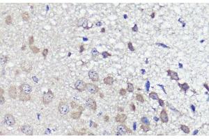Immunohistochemistry of paraffin-embedded Mouse brain using UBL3 Polyclonal Antibody at dilution of 1:100 (40x lens). (UBL3 anticorps)