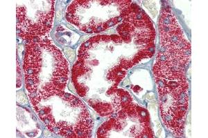 SH3BP2 antibody was used for immunohistochemistry at a concentration of 4-8 ug/ml. (SH3BP2 anticorps  (Middle Region))