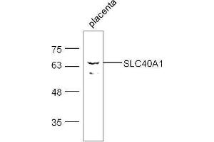 Mouse placenta lysates probed with Rabbit Anti- Polyclonal Antibody, Unconjugated  at 1:500 for 90 min at 37˚C.