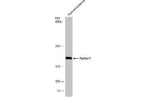 WB Image Human tissue extract (30 μg) was separated by 5% SDS-PAGE, and the membrane was blotted with Factor H antibody [N3C1], Internal , diluted at 1:500. (Complement Factor H anticorps)