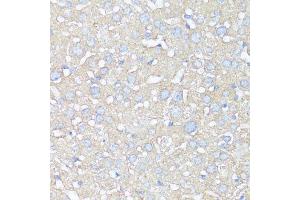 Immunohistochemistry of paraffin-embedded mouse liver using ATG5 antibody. (ATG5 anticorps  (AA 1-275))
