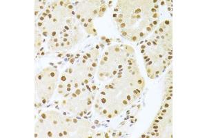 Immunohistochemistry of paraffin-embedded human stomach using ANP32A Antibody.