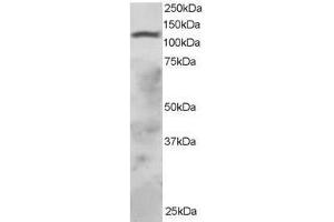 Image no. 1 for anti-Ring Finger Protein 31 (RNF31) (AA 908-921) antibody (ABIN297591) (RNF31 anticorps  (AA 908-921))