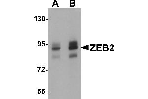 Western Blotting (WB) image for anti-Zinc Finger E-Box Binding Homeobox 2 (ZEB2) (C-Term) antibody (ABIN1030819) (ZEB2 anticorps  (C-Term))