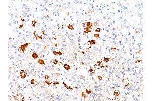 Formalin-fixed, paraffin-embedded human Pituitary stained with TSH beta Mouse Monoclonal Antibody (TSHb/1317). (TSHB anticorps)