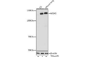 Western blot analysis of extracts of various cell lines, using MD antibody (ABIN7267950) at 1:1000 dilution. (IFIH1 anticorps)