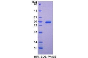 SDS-PAGE (SDS) image for TIMP Metallopeptidase Inhibitor 3 (TIMP3) (AA 31-209) protein (His tag) (ABIN2126969)