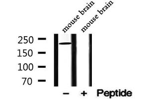 Western blot analysis of extracts from mouse brain, using DENND4A Antibody.