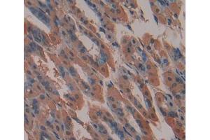IHC-P analysis of stomach tissue, with DAB staining. (ABCA9 anticorps  (AA 1422-1589))