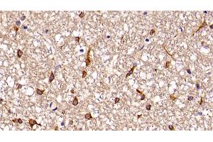 Detection of GbL in Porcine Cerebellum Tissue using Polyclonal Antibody to G Protein Beta Subunit Like Protein (GbL)