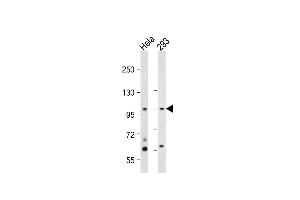 All lanes : Anti-hNEK4- at 1:2000 dilution Lane 1: Hela whole cell lysate Lane 2: 293 whole cell lysate Lysates/proteins at 20 μg per lane. (NEK4 anticorps  (C-Term))