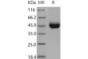 Western Blotting (WB) image for CD5 (CD5) (AA 1-371) protein (His tag) (ABIN7320289)
