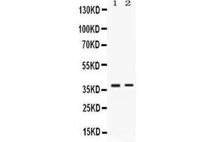 Western blot analysis of TNFRSF14/HVEM expression in HELA whole cell lysates ( Lane 1) and SW620 whole cell lysates ( Lane 2).