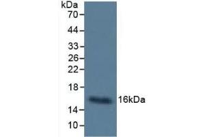 Detection of Cys-C in Human Urine using Monoclonal Antibody to Cystatin C (Cys-C) (Cystathionine-gamma-Synthase Precursor (CYS) (AA 27-146) anticorps)