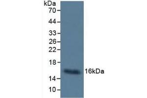 Detection of Cys-C in Human Urine using Monoclonal Antibody to Cystatin C (Cys-C) (CST3 anticorps  (AA 27-146))