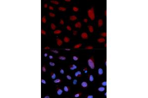 Immunofluorescence analysis of U2OS cell using TNNC1 antibody. (TNNC1 anticorps)