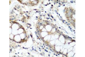 Immunohistochemistry of paraffin-embedded Human colon using NAA60 Polyclonal Antibody at dilution of 1:200 (40x lens).