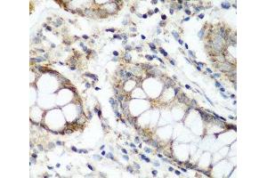 Immunohistochemistry of paraffin-embedded Human colon using NAA60 Polyclonal Antibody at dilution of 1:200 (40x lens). (NAT15 anticorps)