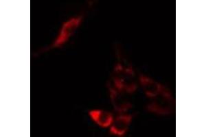 ABIN6275252 staining A549 cells by IF/ICC. (MPHOSPH9 anticorps  (Internal Region))
