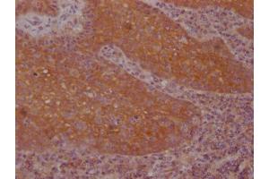IHC image of ABIN7127495 diluted at 1:100 and staining in paraffin-embedded human tonsil tissue performed on a Leica BondTM system.